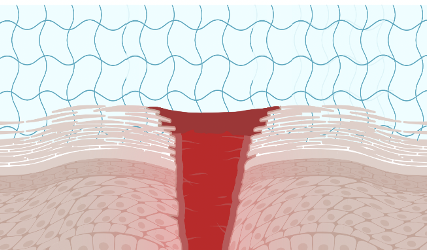 Antimicrobial Hydrogen Research